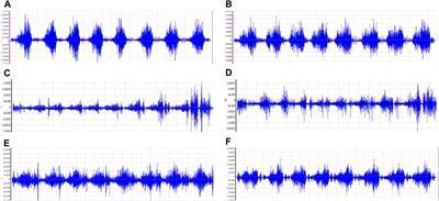 Enhancing lower limb and core muscle activation with blood flow restriction training: a randomized crossover study on high-intensity squat exercises